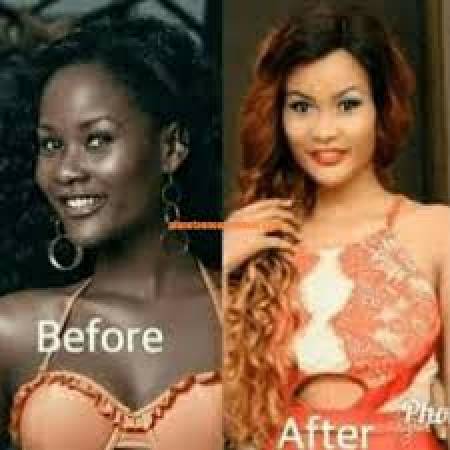 @Immediate suppliers@+27695222391 Kempton Park new face &body whitening cream,PRODUCTS Dark Spots/ Stretch Marks. pills, injection in Vereeniging,