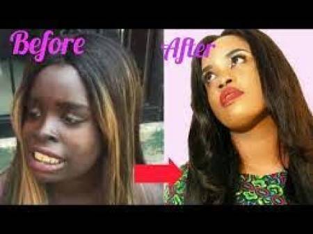 @IN FEW HOURS@+27695222391 Kempton Park new face &body whitening cream,PRODUCTS Dark Spots/ Stretch Marks. pills, injection in Vereeniging, Orange Far